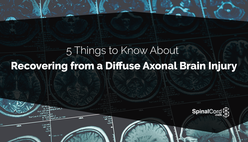 5-things-to-know-about-recovering-from-a-diffuse-axonal-brain-injury